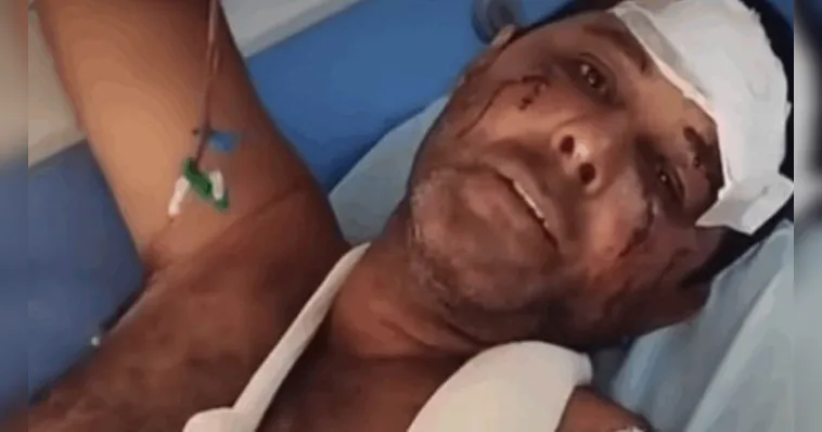 Homem ficou acamado após ataque do felino | Divulgação