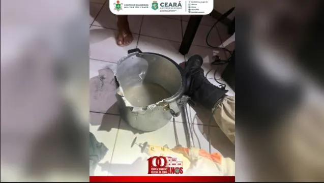 O incidente ocorreu quando o menino entrou na panela, sentou-se dentro dela e ficou com a cabeça e os braços para fora. | Reprodução