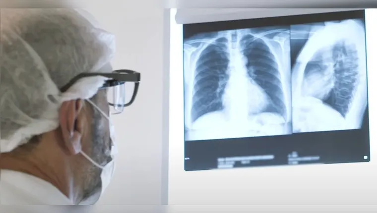 Pneumonia: aumento de casos da doença ascende alerta no Pará. Saiba os sintomas e como se proteger! | Reprodução