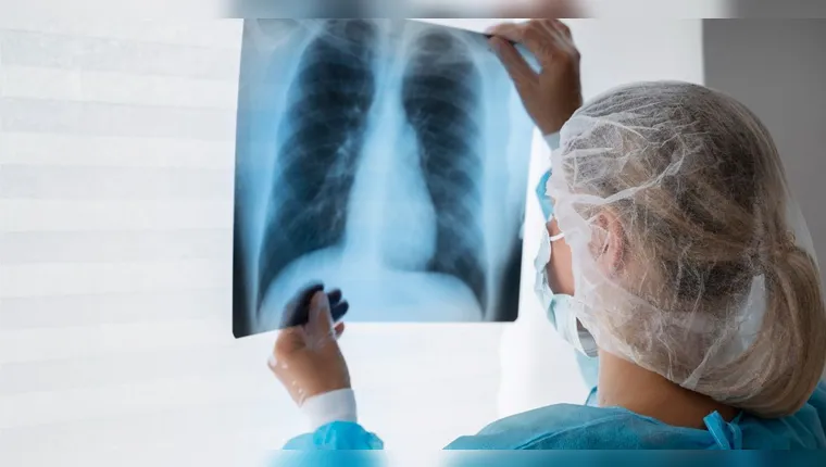 A tuberculose é a infecção que mais mata no mundo | (Freepik)
